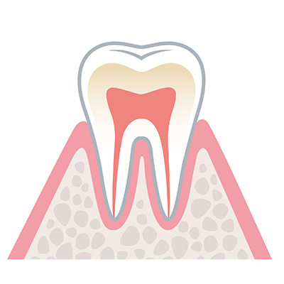 健康な歯ぐきの状態