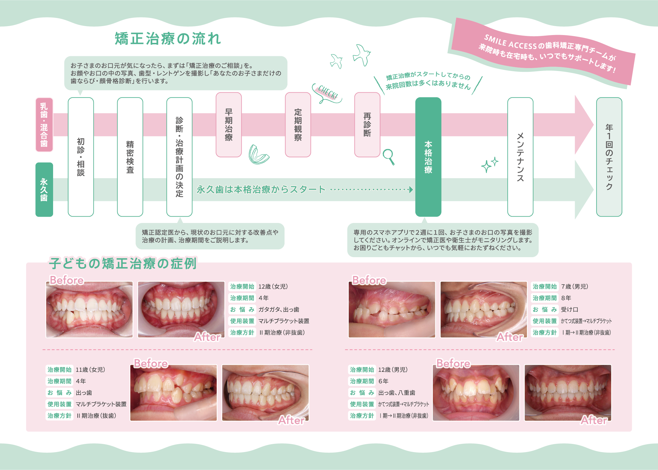 矯正治療の流れ